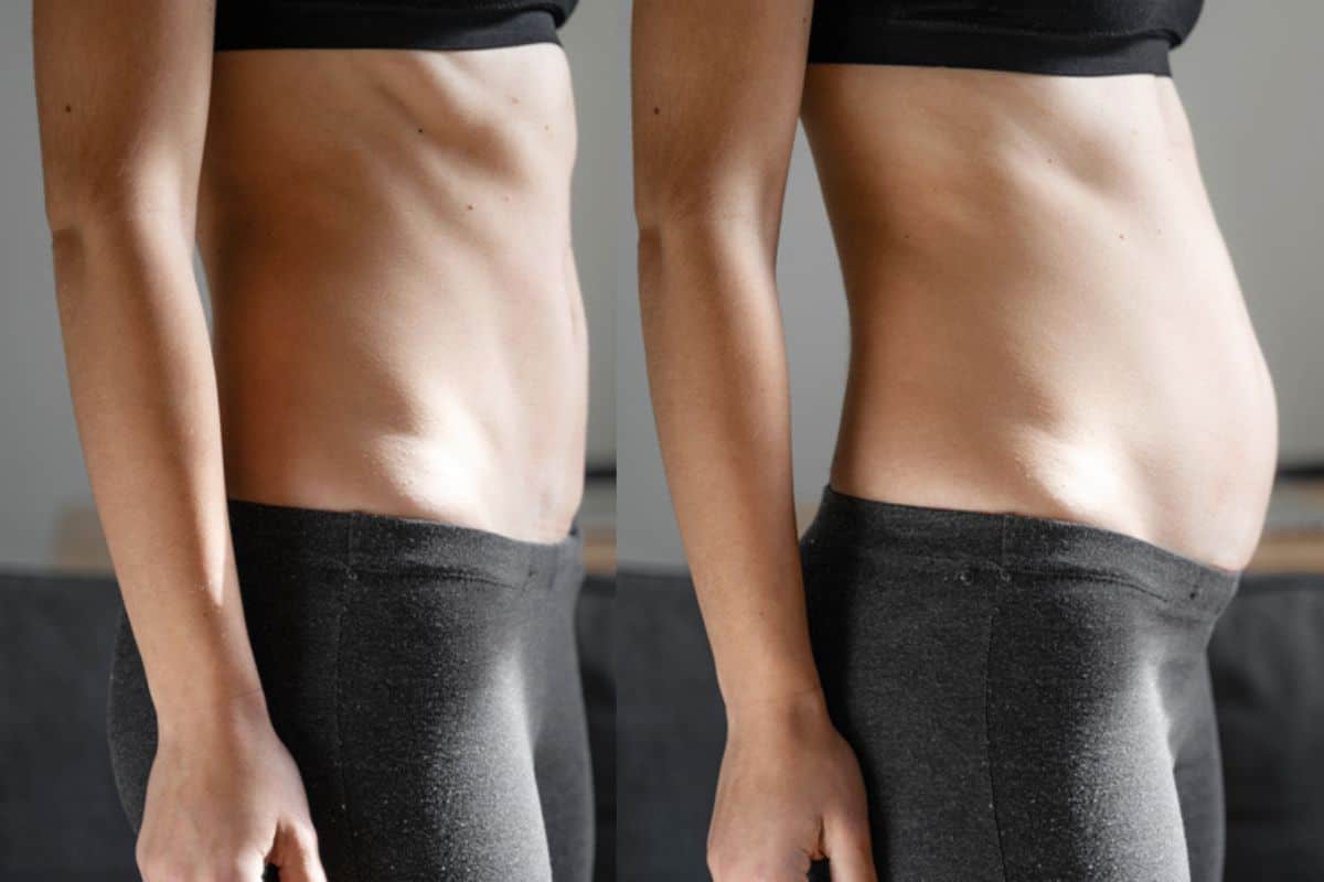 How long does diastasis recti take to improve Birkenhead?