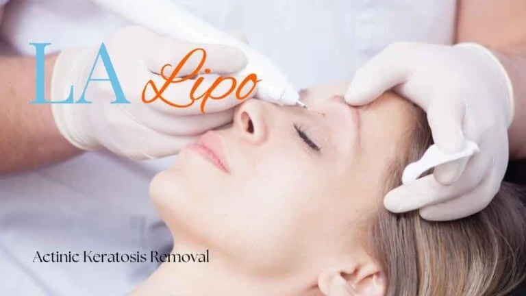 Woman receiving Actinic Keratosis Removal Treatment Birkenhead