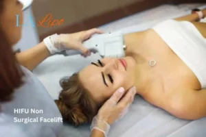 Woman having Hi-Fu to reduce wrinkles Birkenhead.