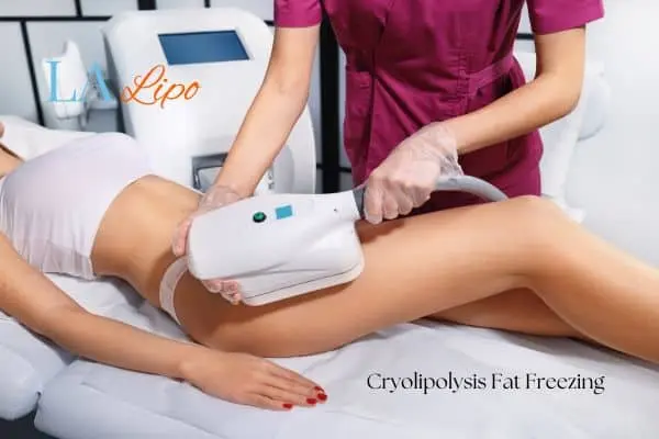 Woman receiving coolsculpting Birkenhead treatment on her thighs
