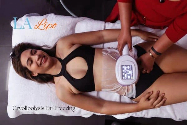 woman getting cryolipolysis Birkenhead