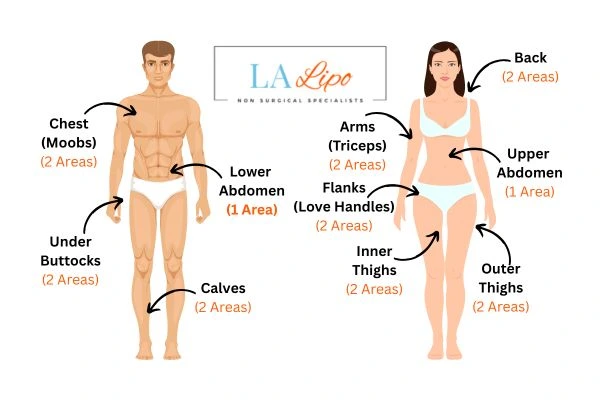 LA LIPO Cryolipolysis Areas Birkenhead