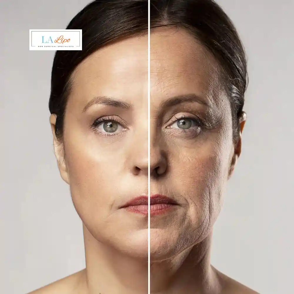 How Can You Tell If Non-Surgical Skin Tightening Is Right for You Birkenhead?