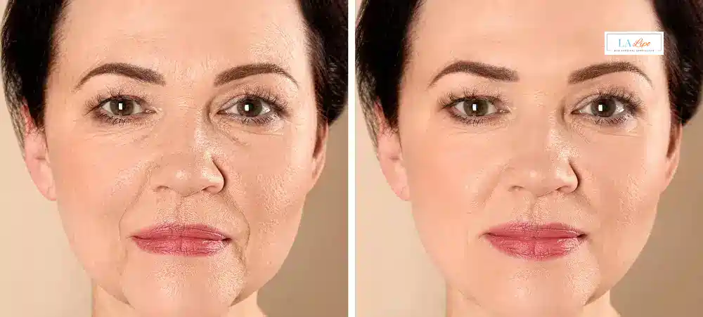 How Long Does It Take to See Results and How Long Do They Last Birkenhead?