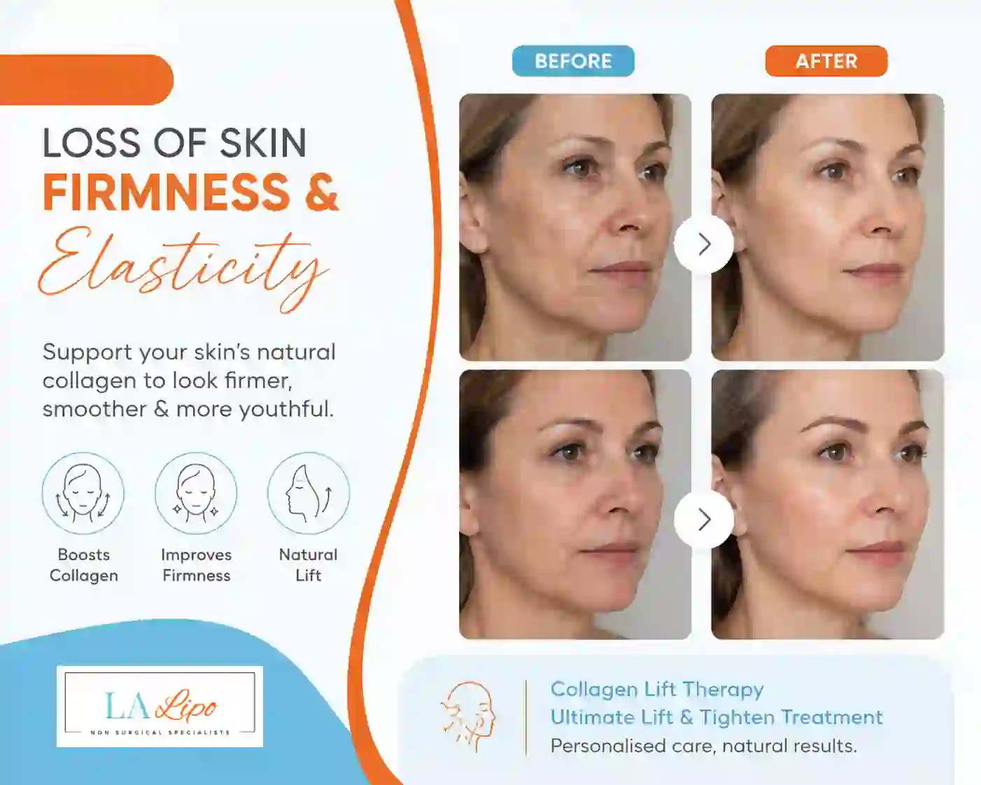 Sign #7: Loss of Skin Firmness and Elasticity Birkenhead